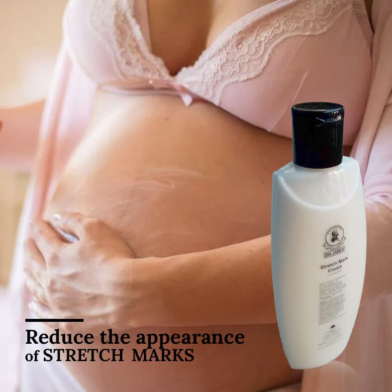 Dr James Stretch Mark Cream For All Skin Type 3